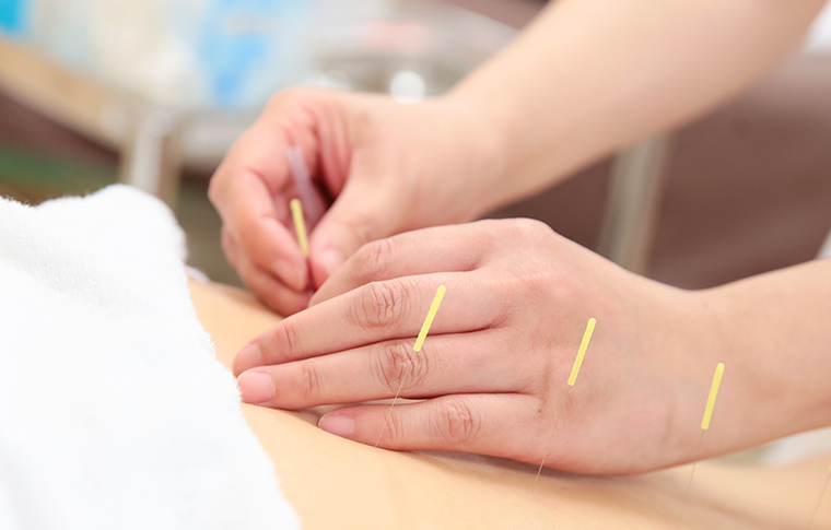 鍼灸・整骨院での導入事例